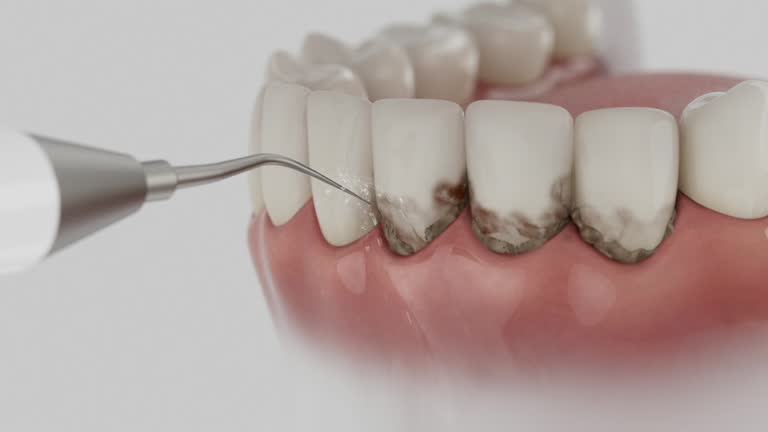 Reliable Teeth Cleaning And Checkup contractor in Mayer, MN by Smile Center Dentistry